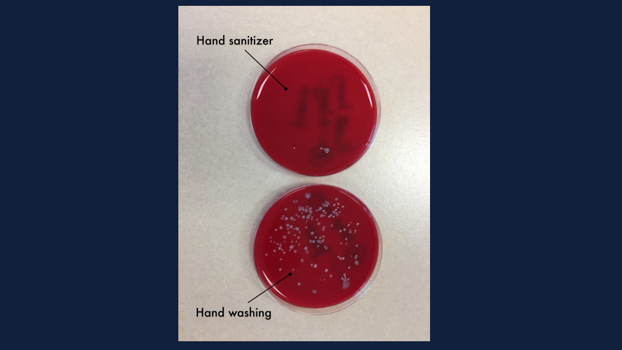 Hand sanitizer vs. soap and water Which works better?